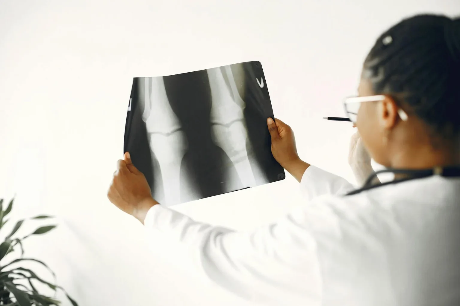 Doctor examining a knee X-ray during orthopedic evaluation