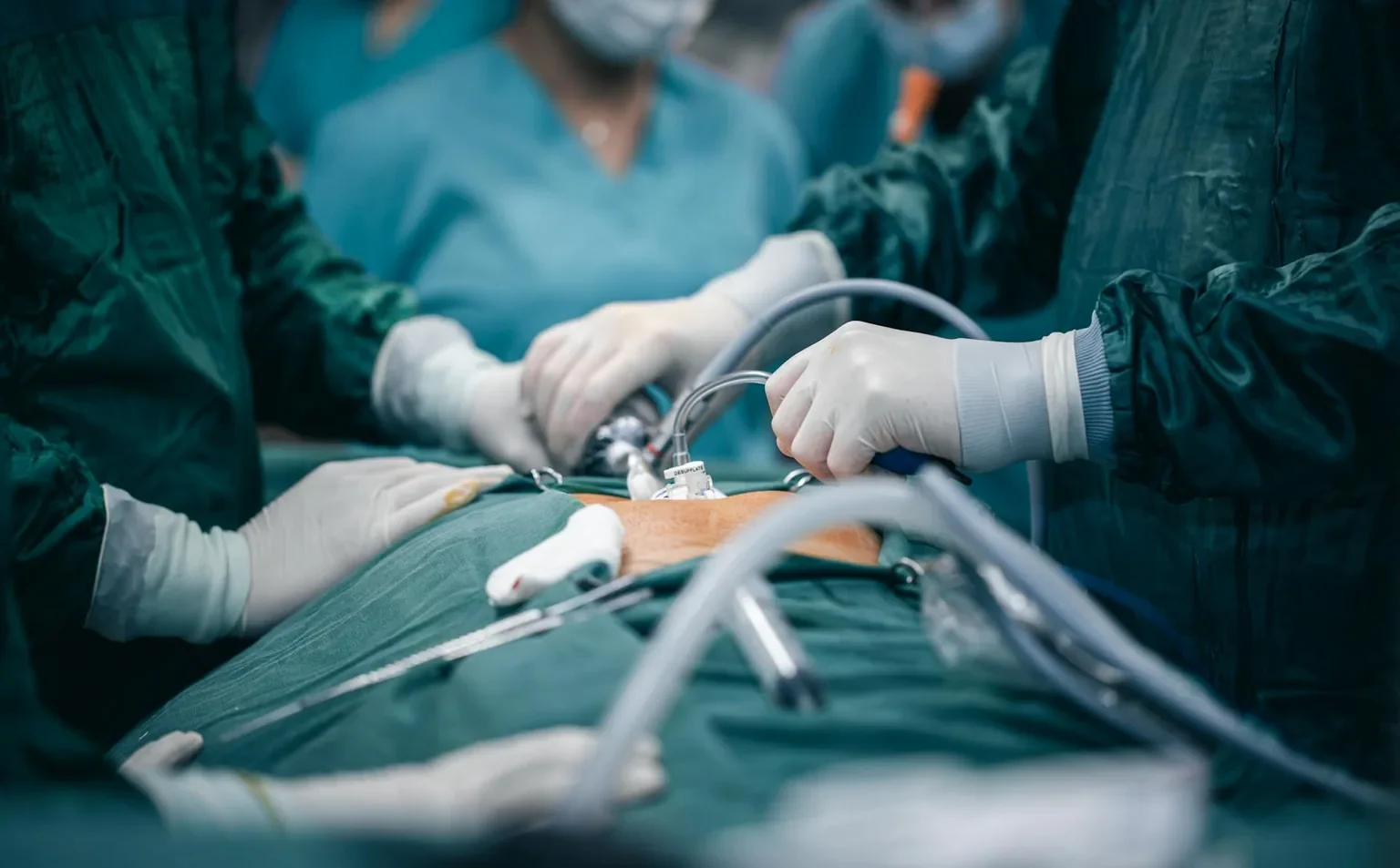A detailed view of surgeons in action during an operation, highlighting surgical precision.
