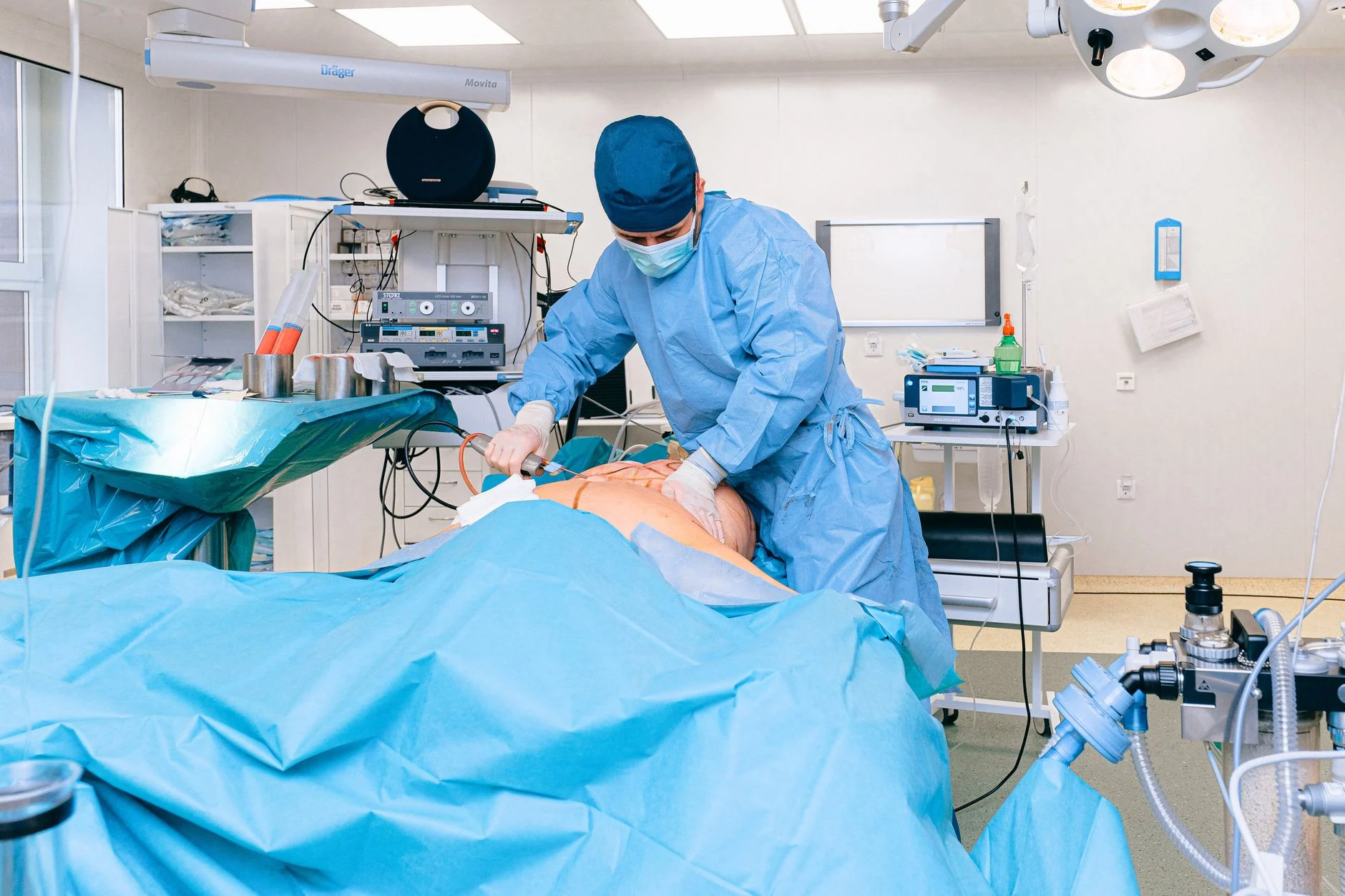 Laparoscopic appendectomy is the standard treatment in most US emergency cases